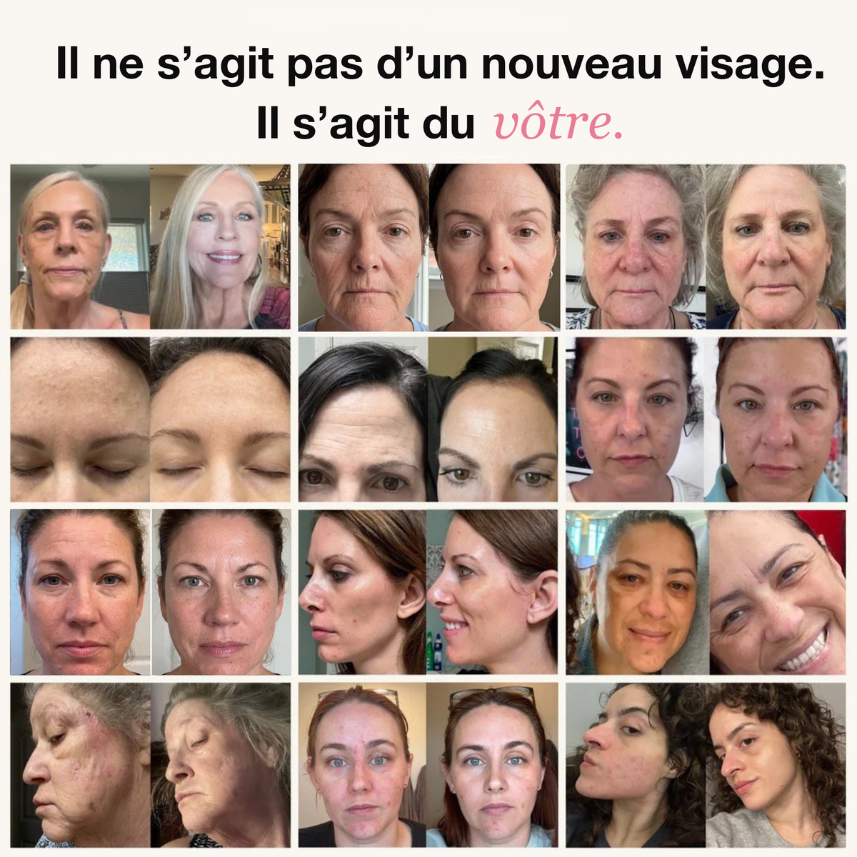 Baume volumisant au collagène