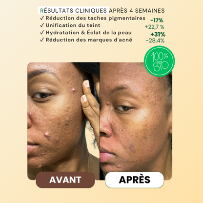 Mousse Purifiante Anti-Taches Au Curcuma