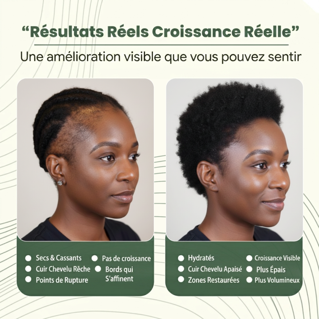 Huile de croissance capillaire naturelle Batana