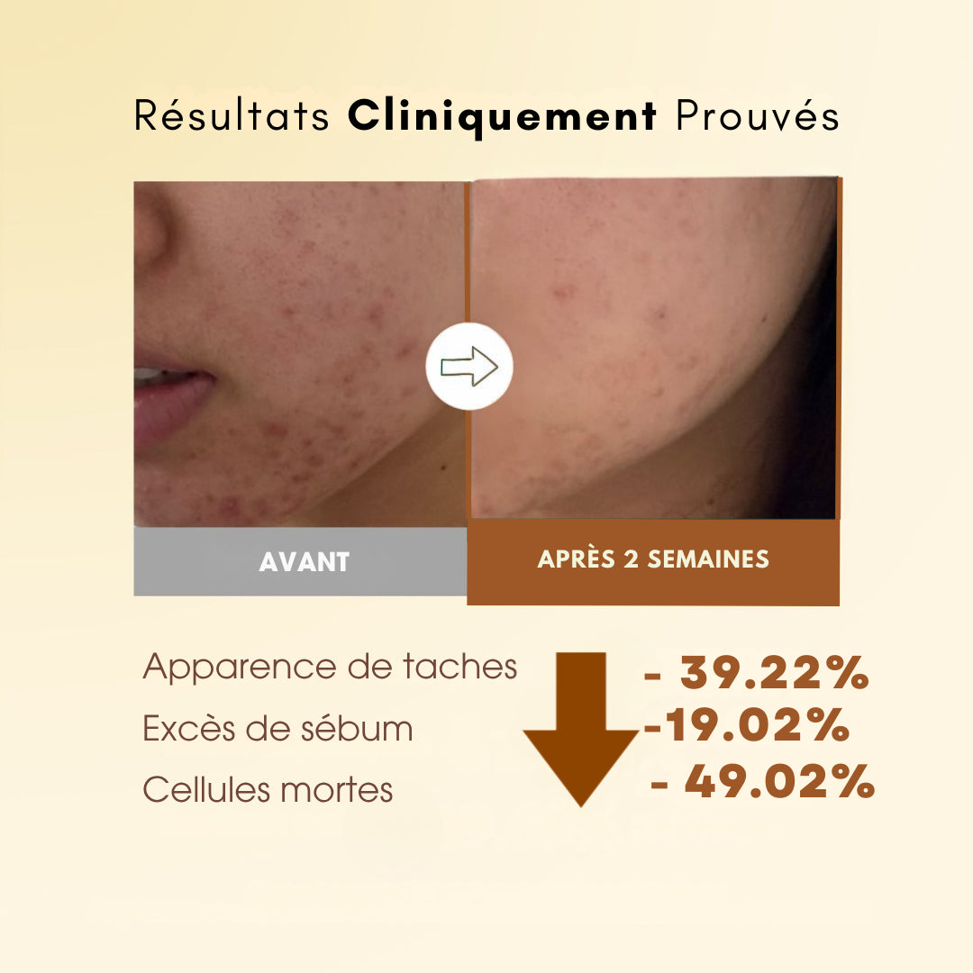 Pads Anti-Taches au Curcuma - 40 unités