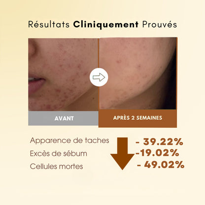 Pads Anti-Taches au Curcuma - 40 unités