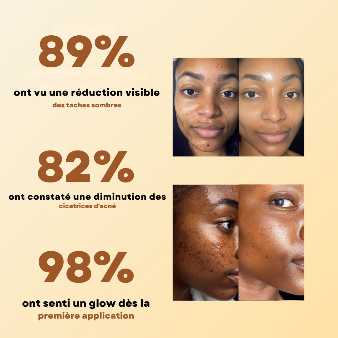 Pads Anti-Taches au Curcuma - 40 unités