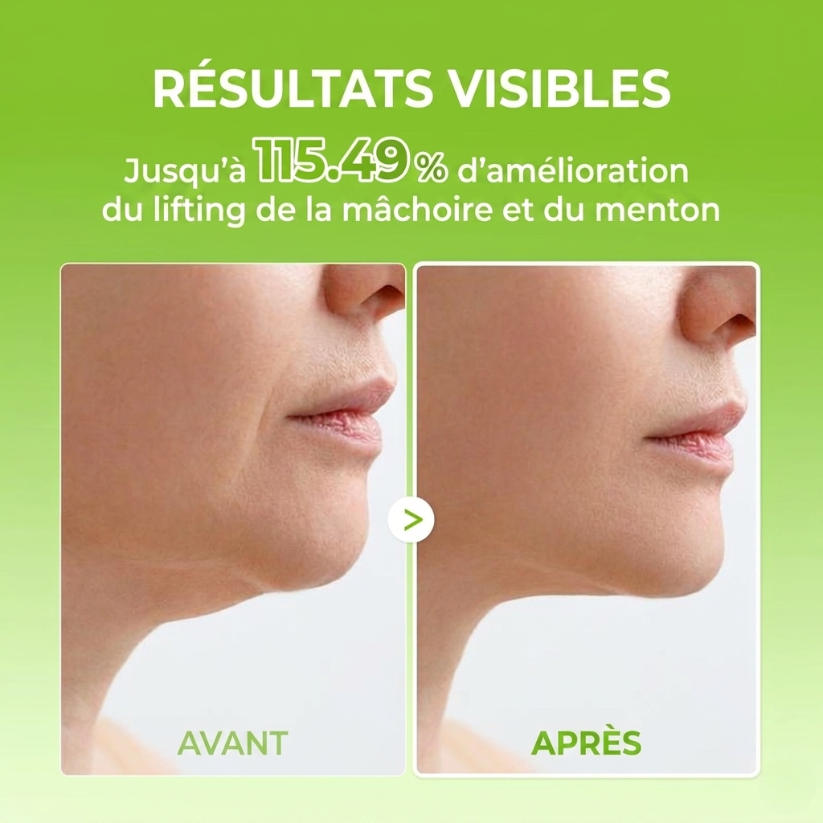 Bande de lifting en V Cactox Mewing (4 masques par paquet)