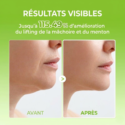 Bande de lifting en V Cactox Mewing (4 masques par paquet)
