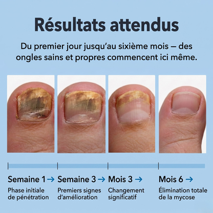Éliminez la mycose des ongles à la racine — et pas seulement en surface.