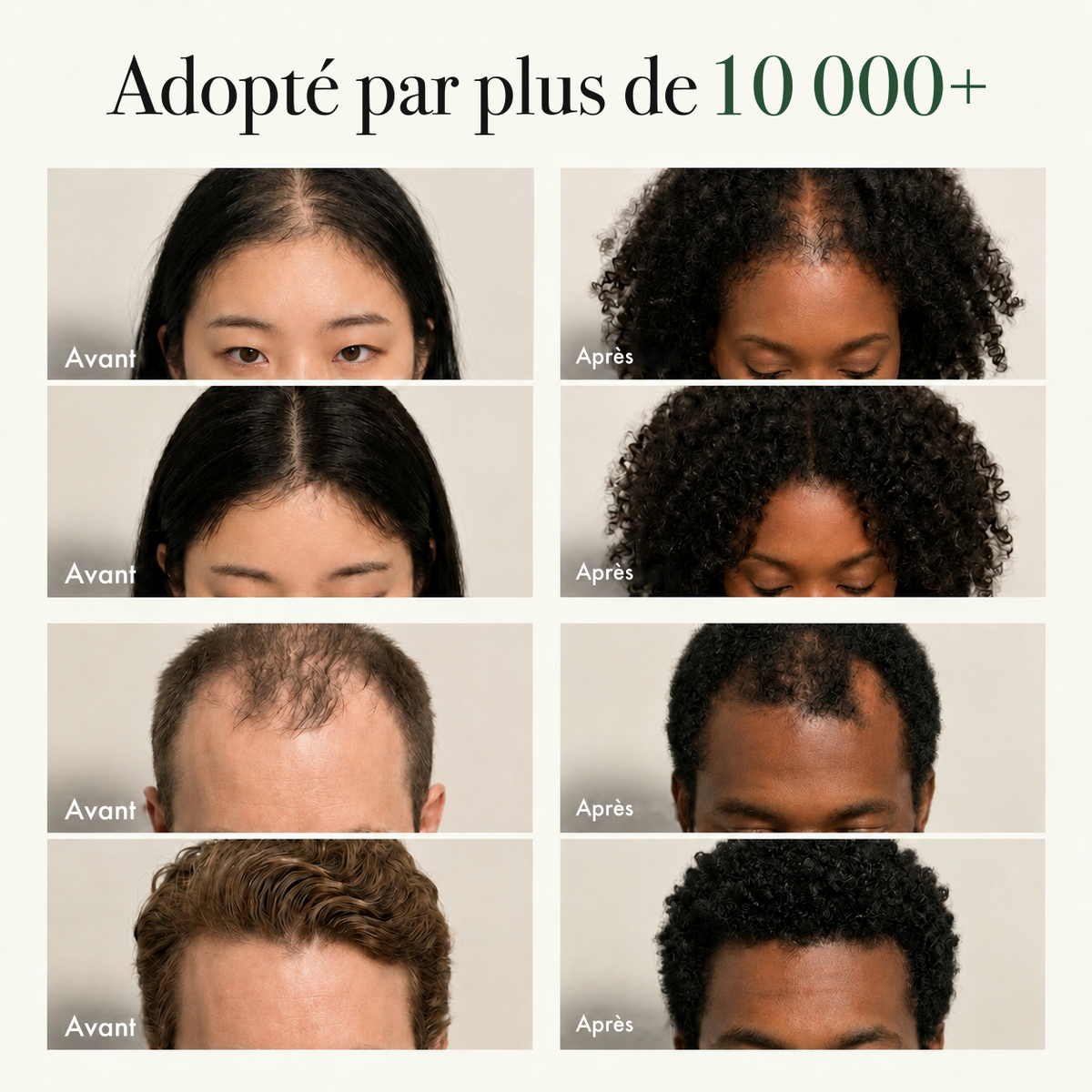 Resultats avant et apres
